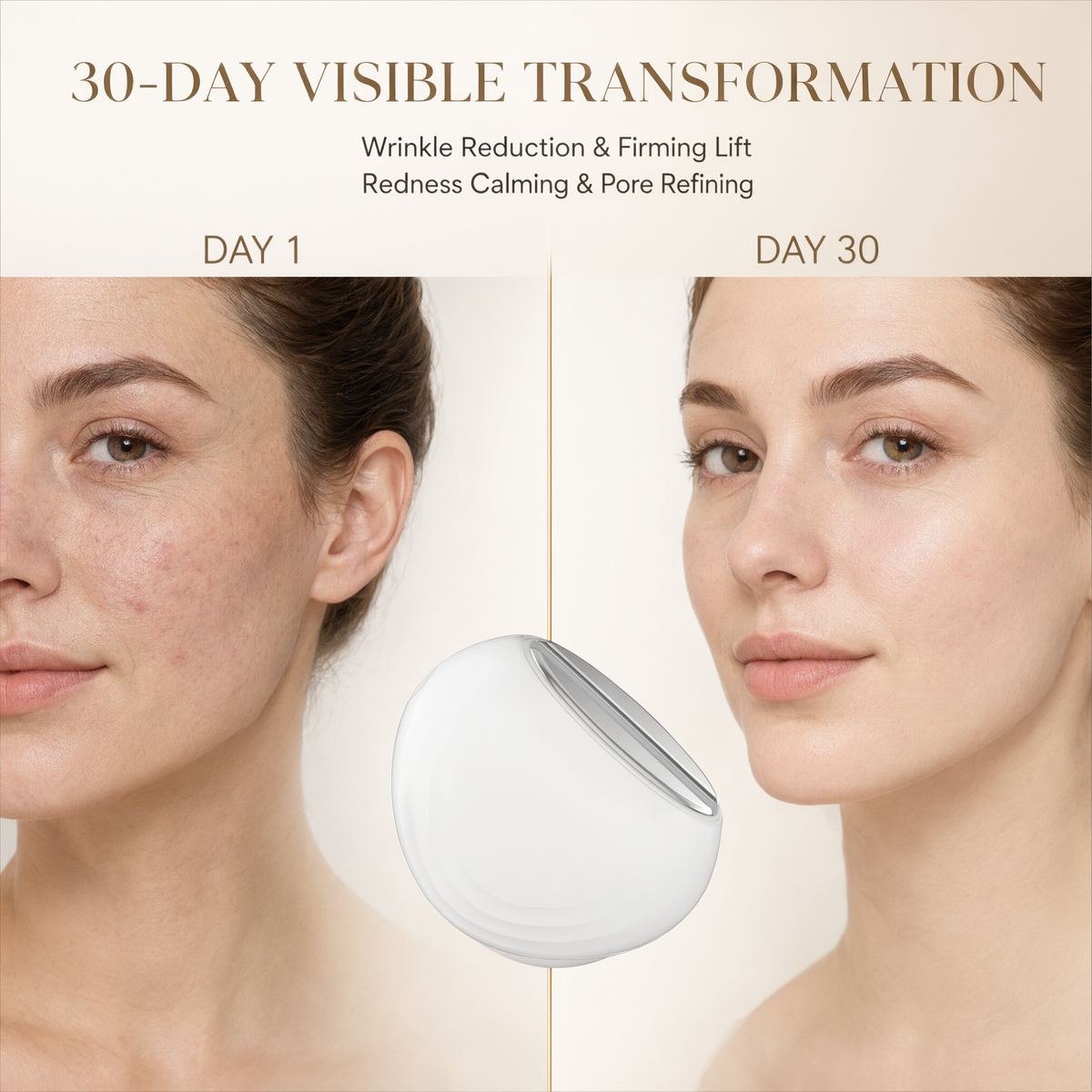 Dispositivo de belleza EMS Photon Vibro-Infusion Lifting
