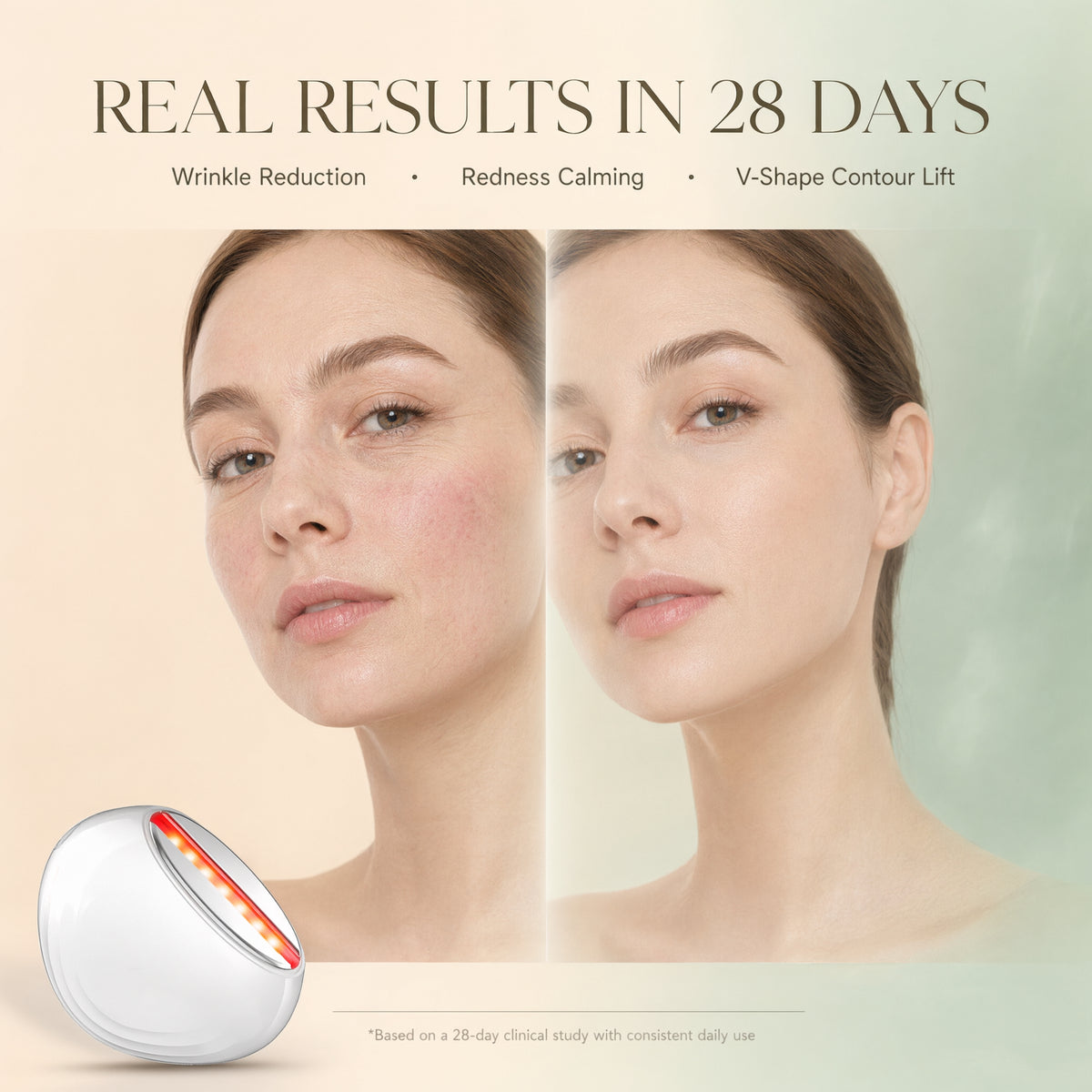 Dispositivo de belleza EMS Photon Vibro-Infusion Lifting